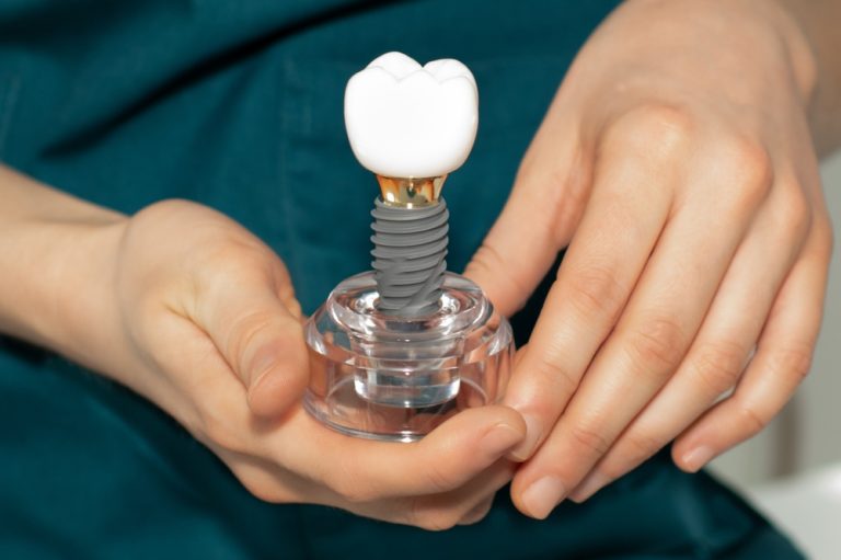 implant-1-1